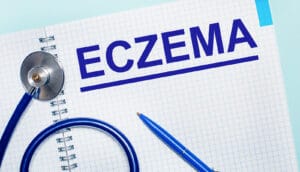 Home Care Assistance in Sun City West AZ: Eczema